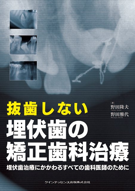 『抜歯しない埋伏歯の矯正歯科治療』の表紙