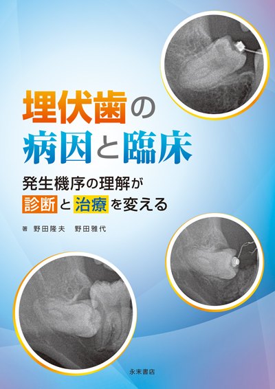 『埋伏歯の病因と臨床』の表紙